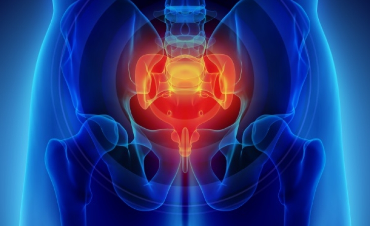 Χρόνιος πυελικός πόνος